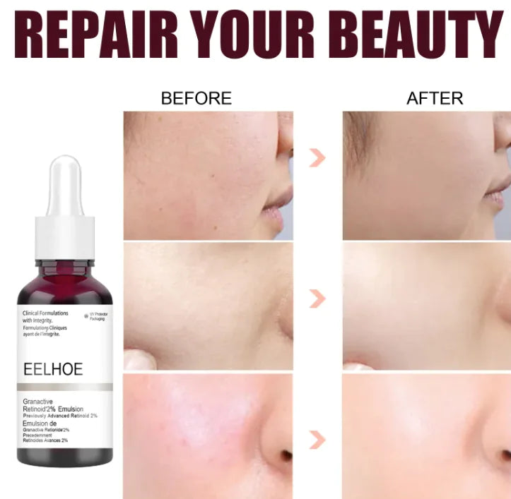 Skin Refining Serum